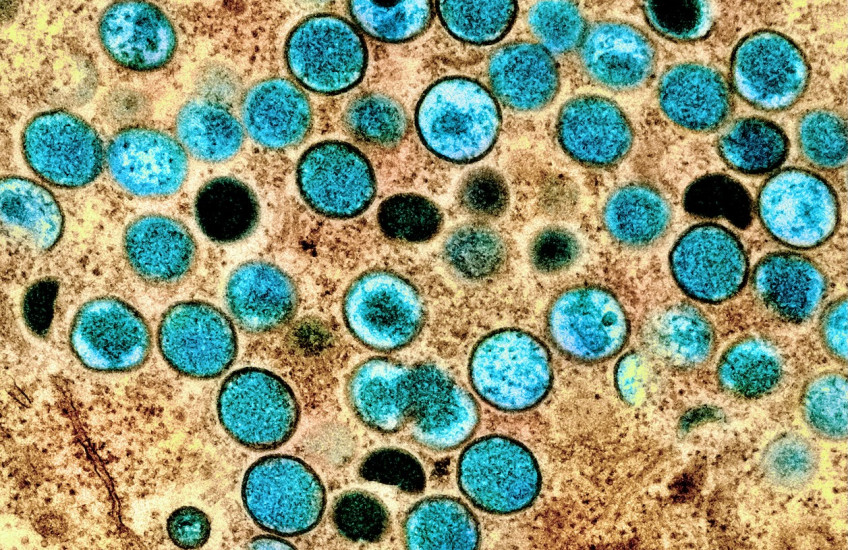 Teal-colored, speckled speres in a textured brown background.