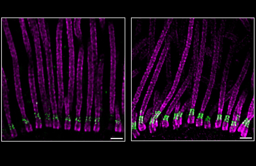 Two collections of about 10 fluorescently labeled cilia under a microscope look like long parallel strands with a short green cuff toward the bottom end.