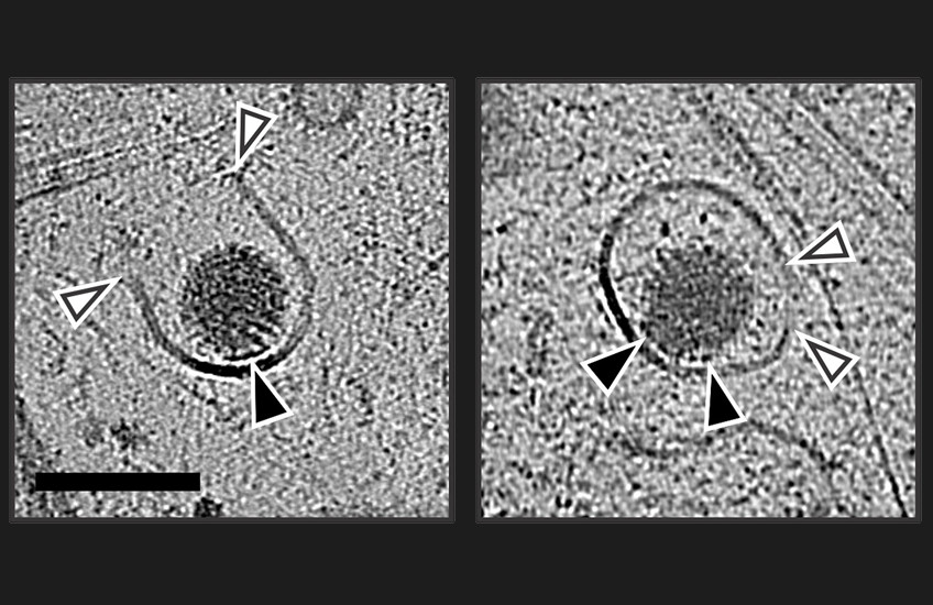 Cryo-electron microscopy views of a round rotavirus enclosed in a membrane-bound compartment. White arrows indicate where viral proteins have created an opening in the membrane.