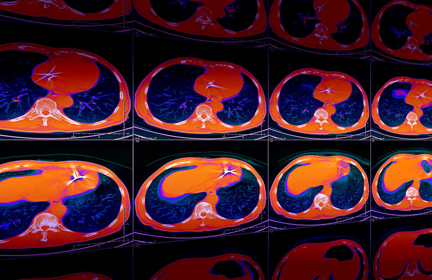 Multiple rows of 2D slices from a chest CT scan