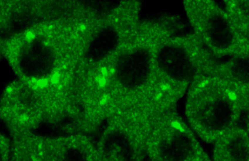 Microscopic image of cells, in green against a black background, many with small, bright fluorescent spots.