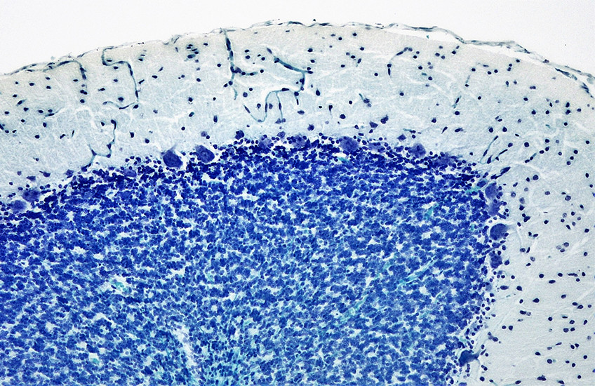Stained cross-section of the cerebellum with Purkinje cells visible