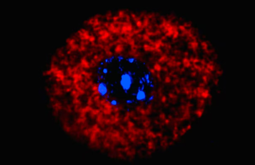 Microscope image of neurons after allergen exposure.