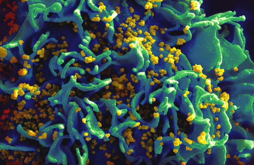 HIV Vaccine Takes Big Step