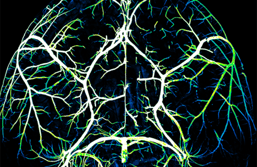 circle of willis