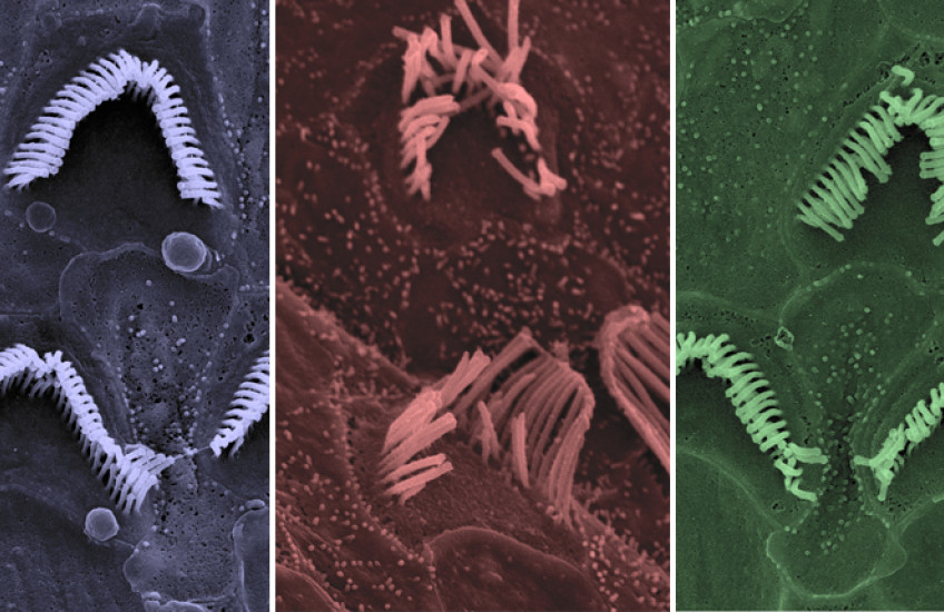 hearing cells