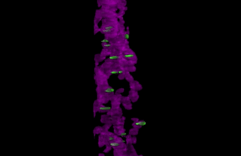 Zeroing In on Dopamine