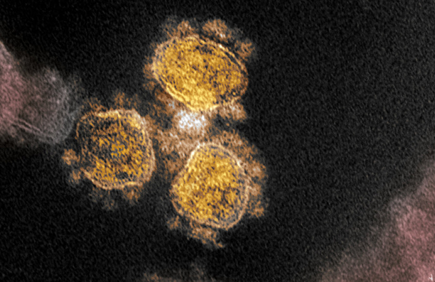 Colorized micrograph of three SARS-CoV-2 viral particles against a dark background