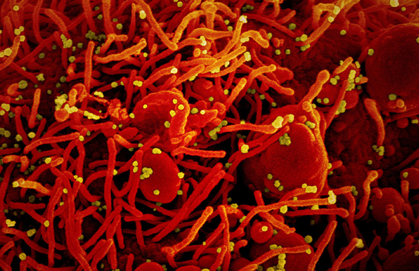 Colorized micrograph has dozens of yellow specks stuck to a textured red cell surface