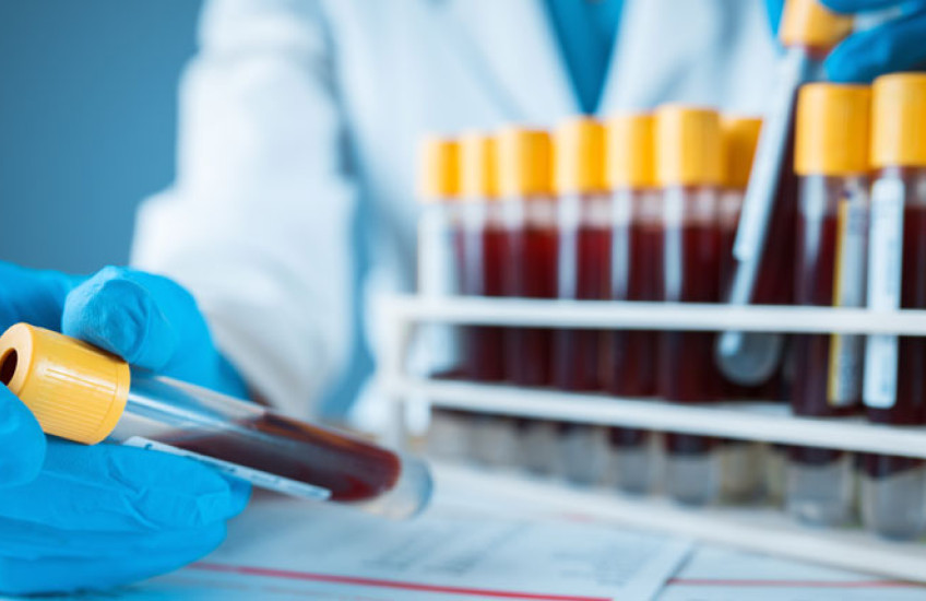 Image of blue-gloved hand holding a test tube full of blood 