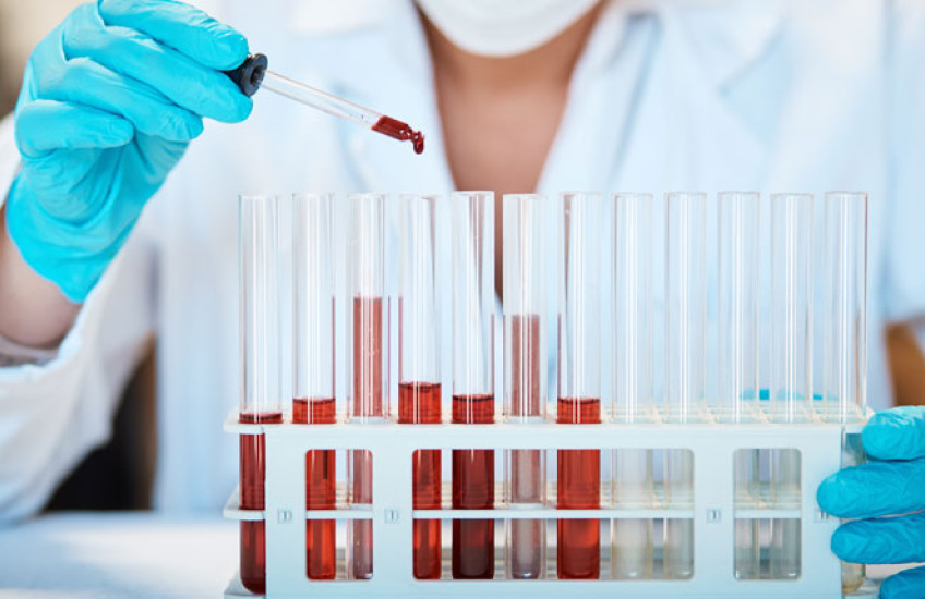Photo of a person in a lab coat holding an eye dropper of blood over some glass vials 