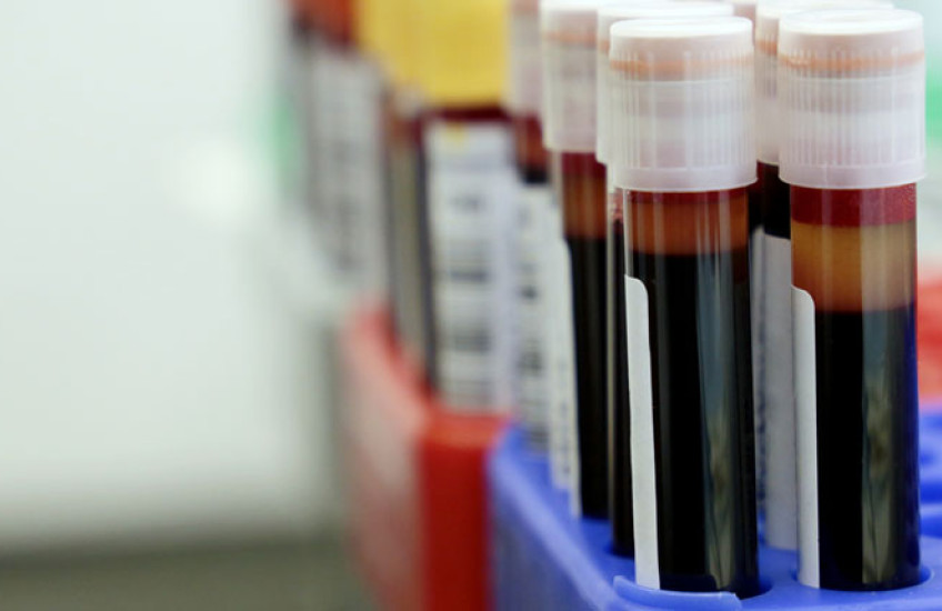 Test tube vials filled with red liquid 