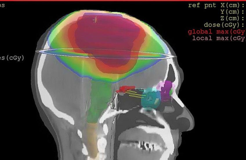 MRI-type image of brain scan, profile view 