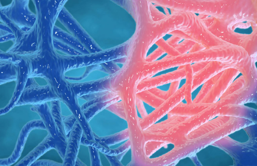 Illustration of inflammation, with some nerve endings pink, the rest blue