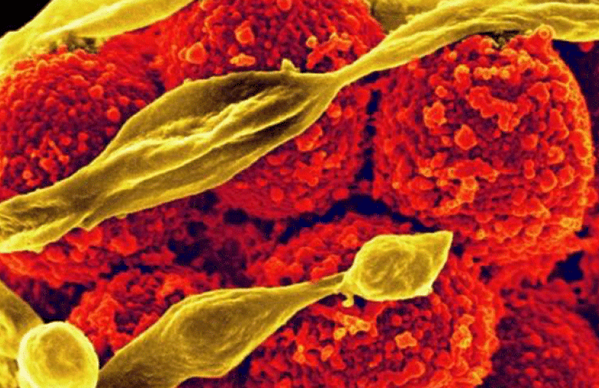 A cluster of red, textured balls wrapped in gold 