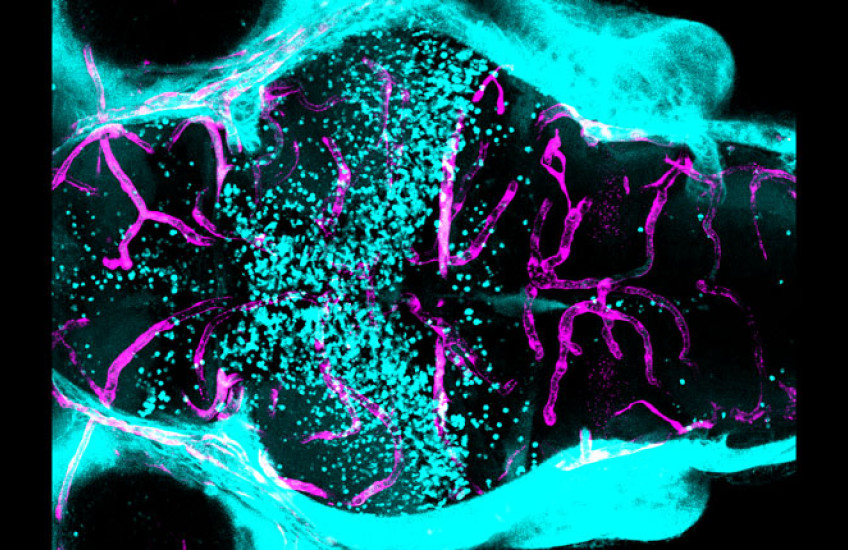 A blue, pink, and black image of a zebrafish brain