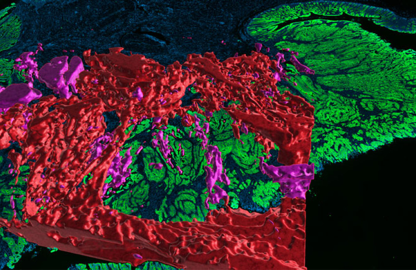 3D red and pink patches on top of a 2D green and blue area