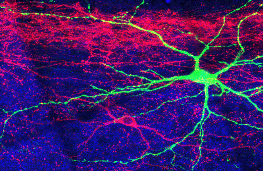 Patches of bright pink, purple, and green representing different types of neurons