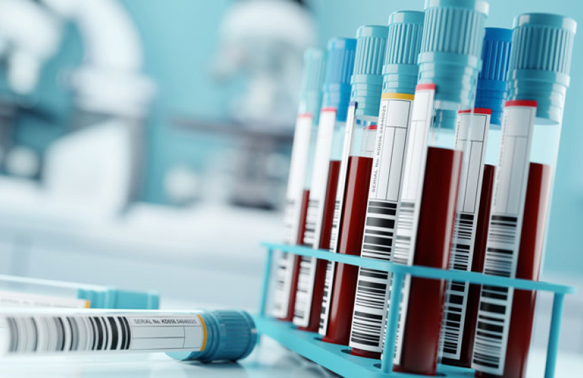 A rack of tubes containing blood samples, with two empty tubes lying down