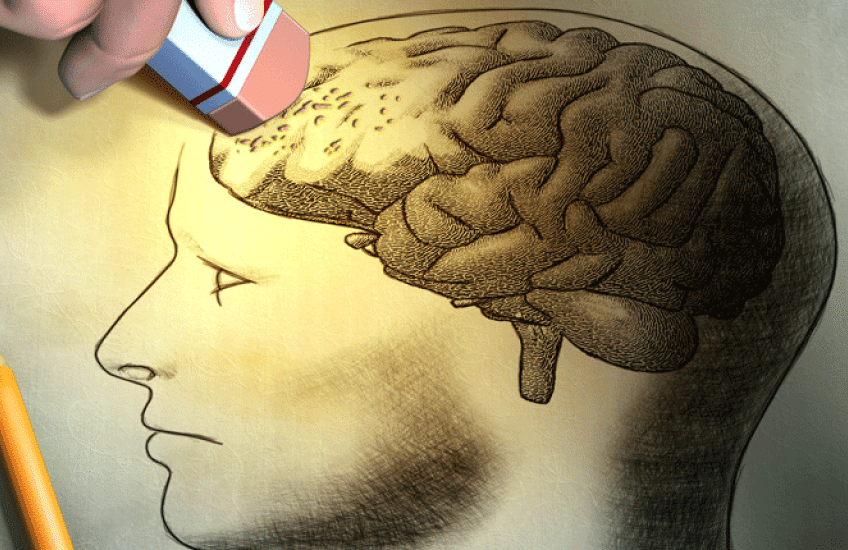 A drawing of a brain inside a human head, with the front portion of the brain being erased