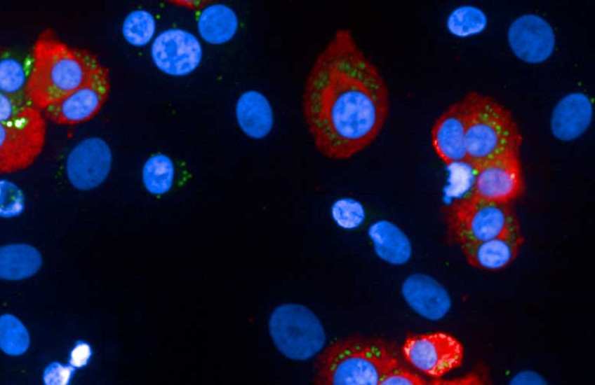 Human beta cells and insulin granules 