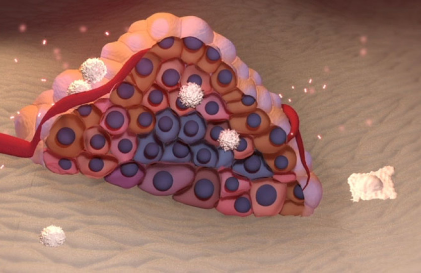 An illustration of a cluster of cancer cells forming a tumor