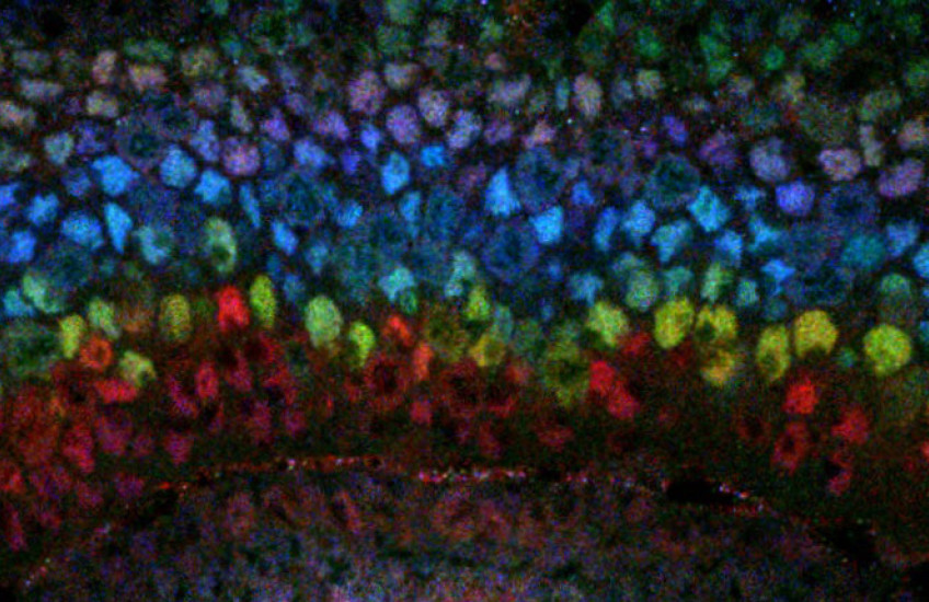 Layers of different colored dots, representing cells
