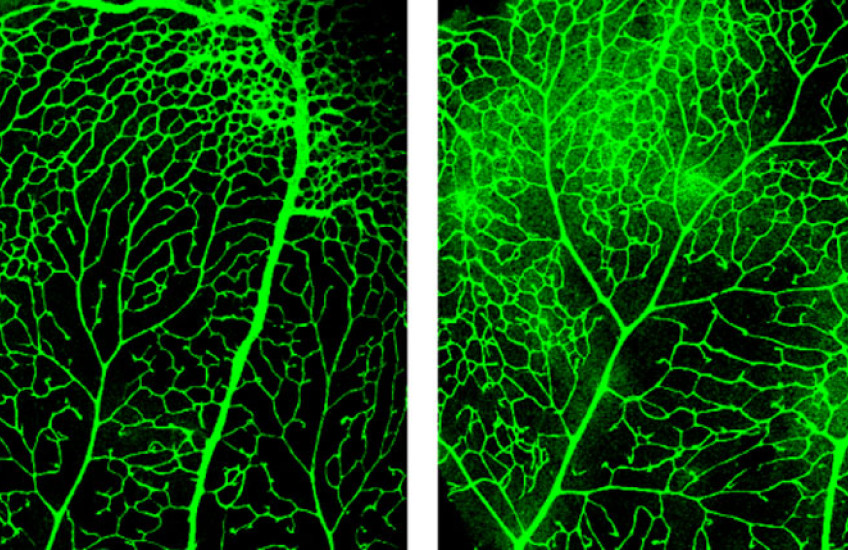 A pair of microscope photos showing blood vessels in the blood-retina barrier dyed green with fluorescent dye