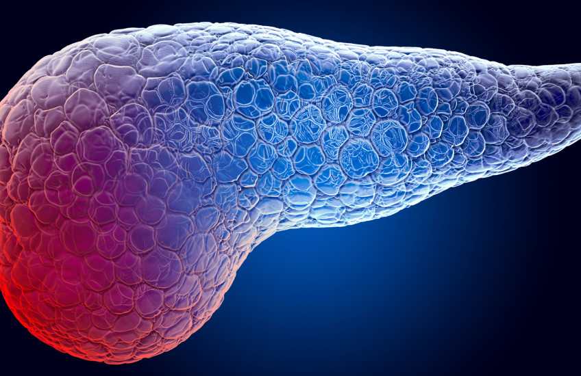 illustration of pancreas in blue and red; the red is meant to show pain