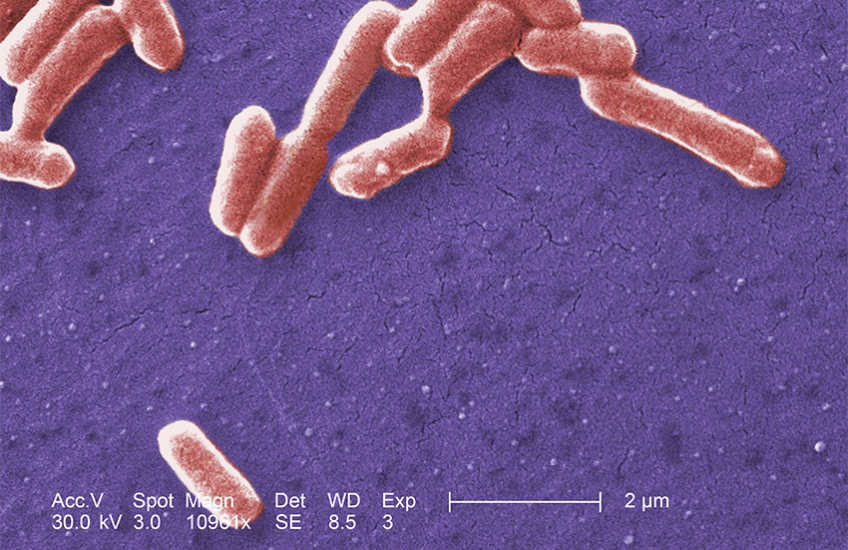 Micrograph with pill-shaped E. coli bacteria shown in pink against a purple background