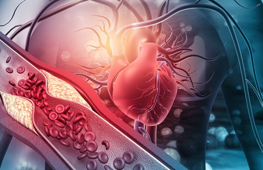 digital image of heart and blocked arterty