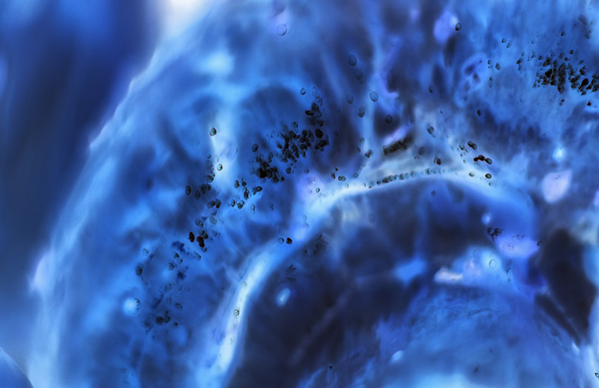 cancer cell close-up