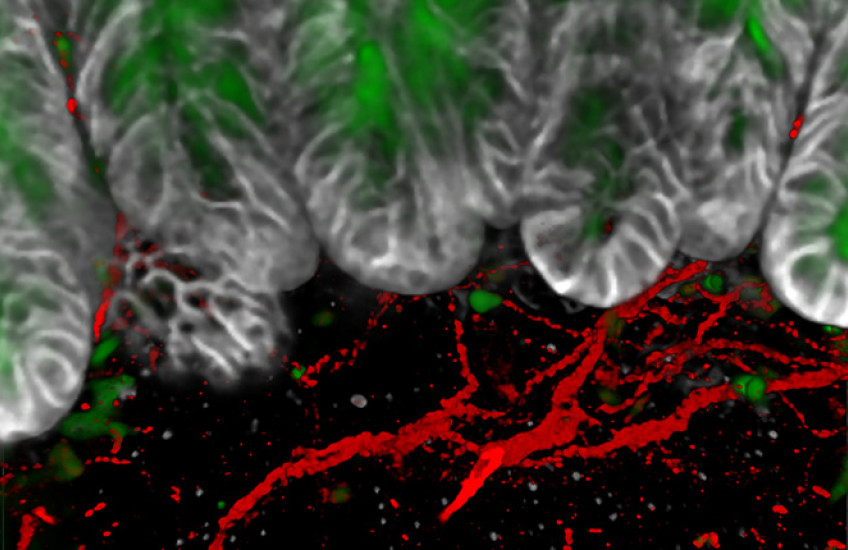 Image of nerves (red), goblet cells (green), and ephithelial cells (gray)
