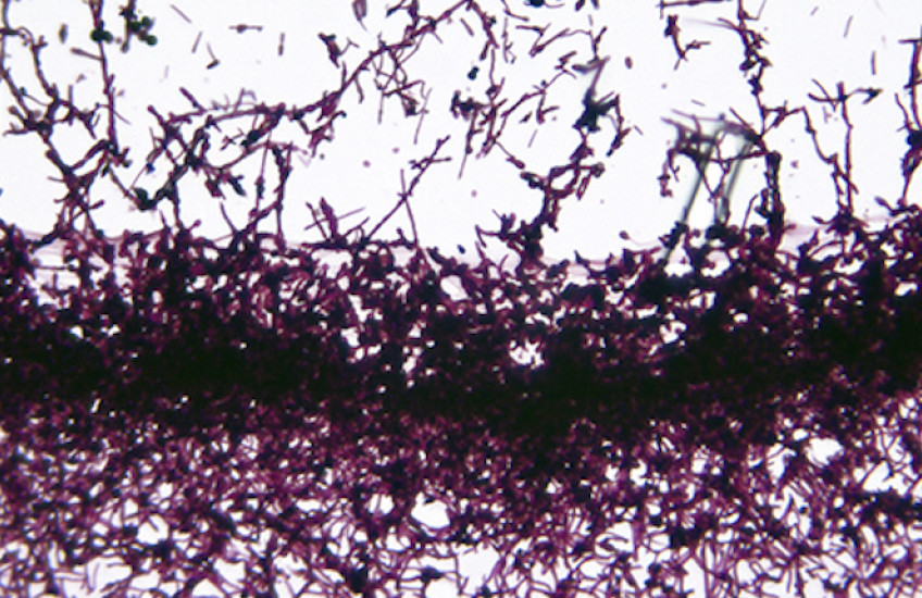 Combating Candida Albicans