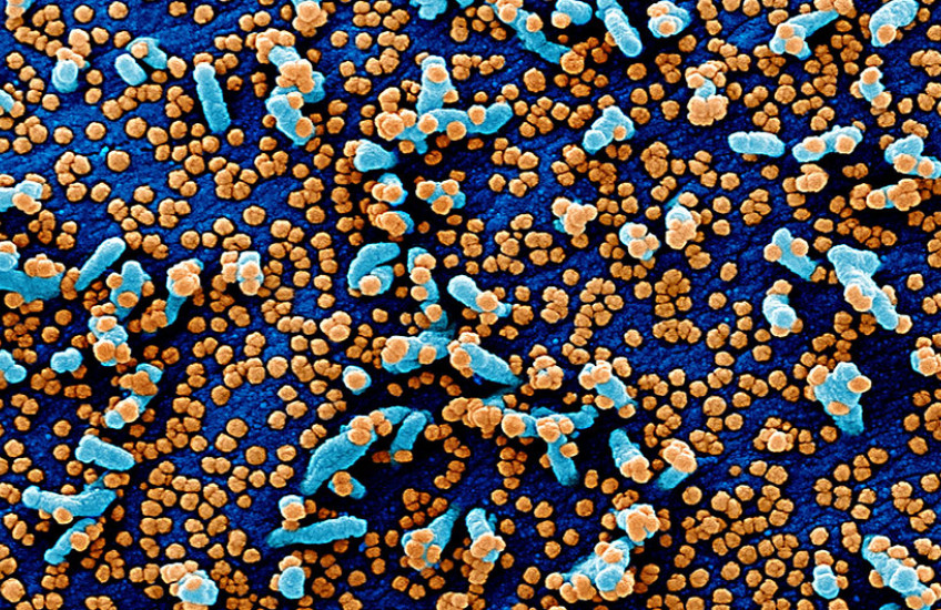 Image of SARS-CoV-2 magnified