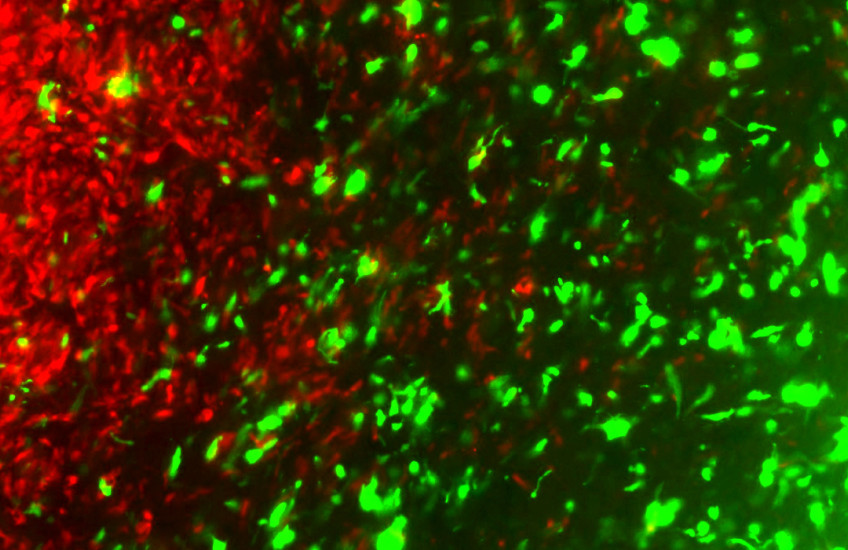 Crispr-Cancer