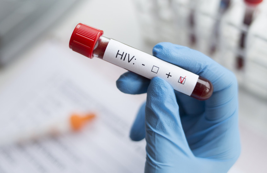Photo of a gloved hand grasping a blood-test tube labeled "HIV+"; hand is wearing a blue medical glove; background is blurred blood-test tubes and notebook