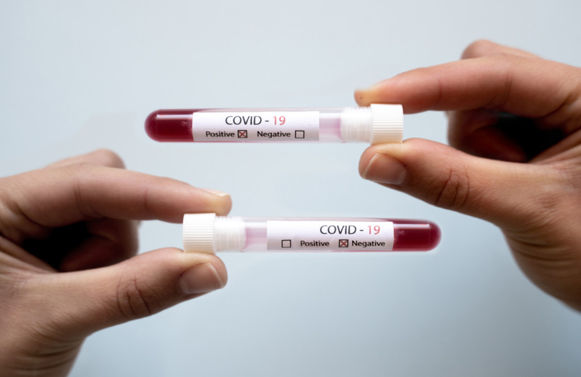 Two hands, each holding a covid-19 blood test, one negative, one positive