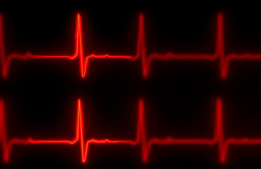 Two horizontal red lines punctuated with jagged peaks representing a heart beat on an electrocardiogram