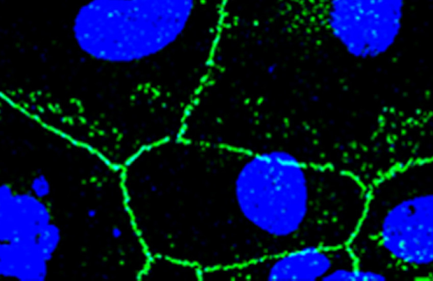 Confocal microscopy image of a whole mount of female mouse CE at 3 months post 500 J/cm2 UVA (green: ZO-1 staining (tight membrane junctions); blue: nuclear staining using DAPI)