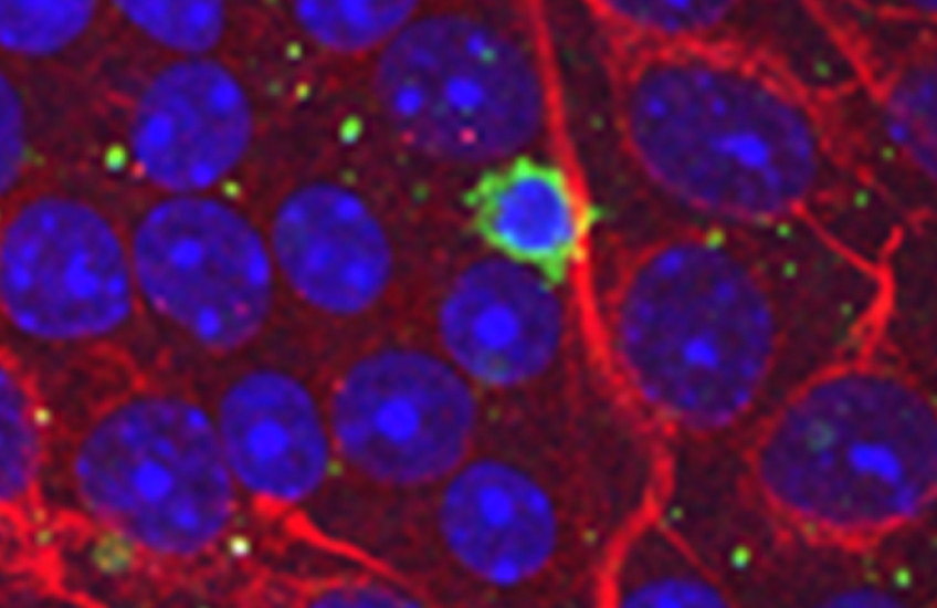 Elevated eye pressure can cause T cells, shown in green, to infiltrate the eye and attack neurons. 