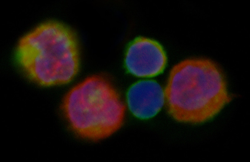 T cells glow blue, red and yellow