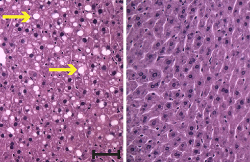 Histology slides show lipid molecules in mouse livers
