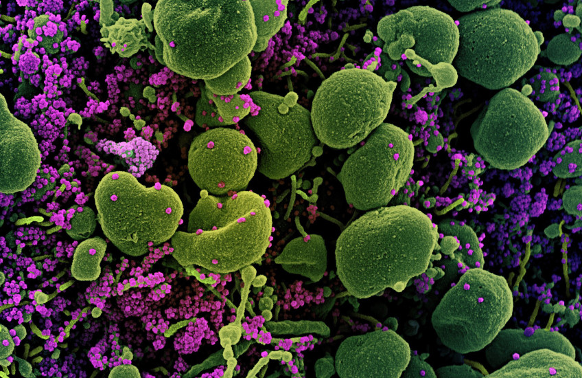 microcopic image of SARS-CoV-2 