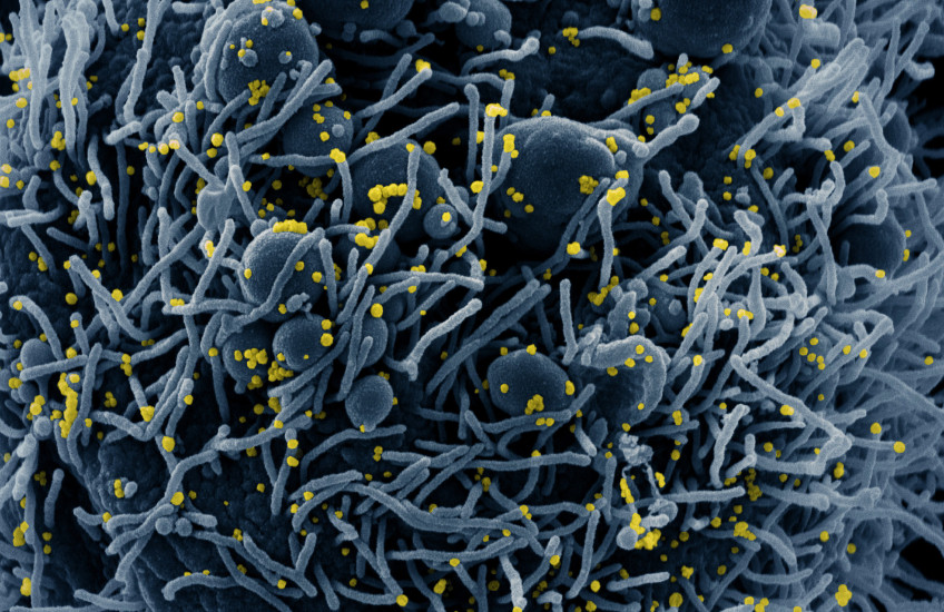 Electron microscopy image of SARS-CoV-2 tinted blue