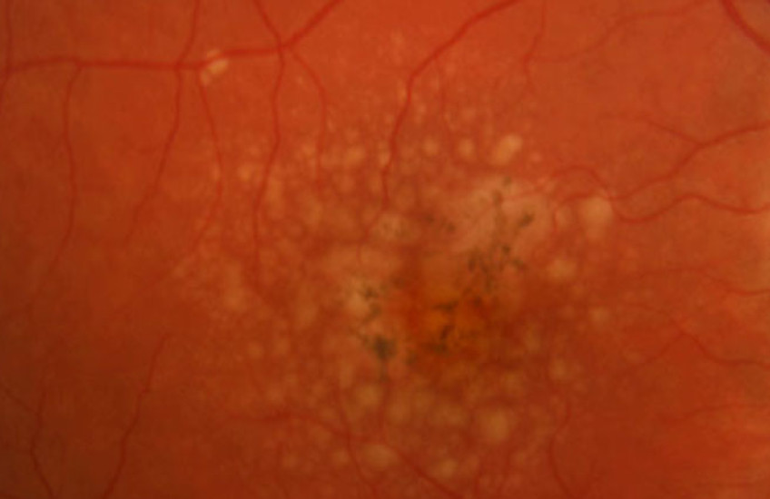 Picking Up the Signals