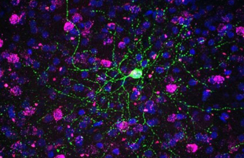 Colorized micrograph shows web of green tendrils emanating from a nucleus against a backdrop of puple nuclei on black
