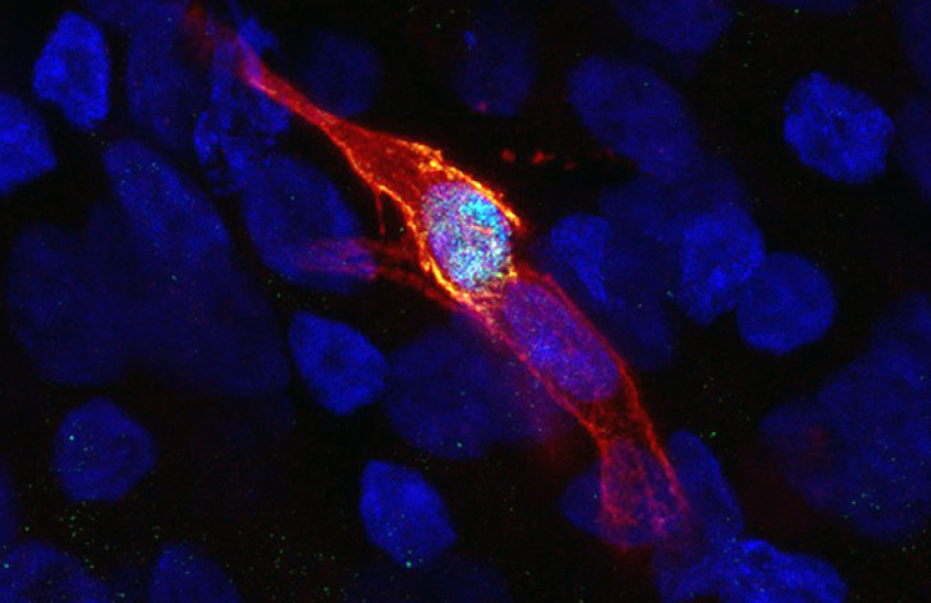 an elongated cell glows orange around the edges against a dark background in a fluorescently-tagged microscope image