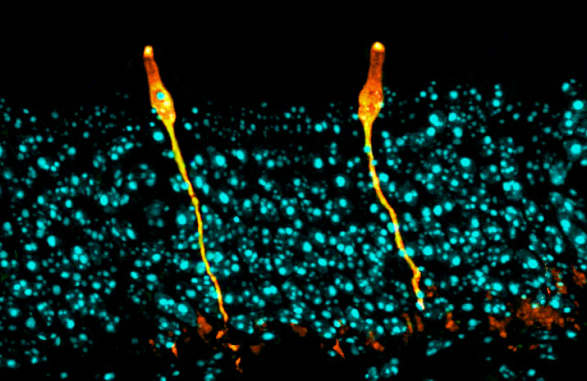Pulmonary Ionocytes