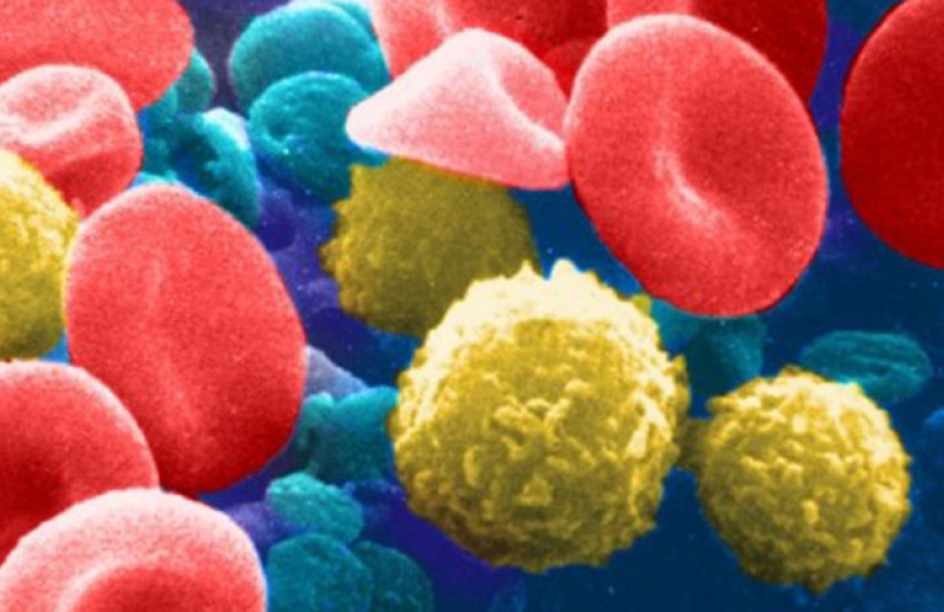Micrograph of disc-shaped red blood cells and ball-shaped white blood cells on colorized blue background